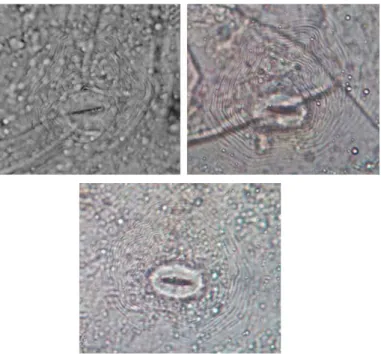 Gambar 5. Analisa sidik pantat pada nematoda betina. 