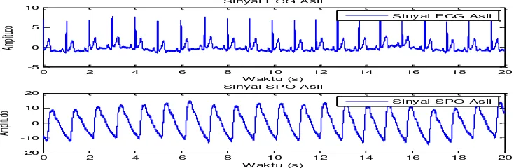 Gambar 4. Data sinyal ECG dan SPO2 Responden Kedua -Laki-laki 
