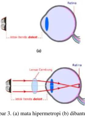 Gambar 4. (a) mata melihat dekat (b) mata melihat dengan bantuan lup  Penggunaan Lup 