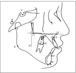 Gambar 12. Landmarks dan bidang referensi yang digunakan . 10. Anterior nasal spine (ANS); 11