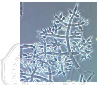 Gambar 2.6. Morfologi Trichoderma harzianum dengan perbesaran 400 kali   Sumber : USDA (2008) 