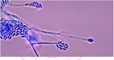 Gambar 2.3. Morfologi Fusarium oxysporum. 