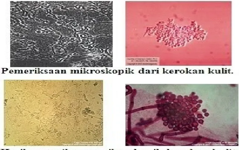 Gambar 1.  P. Ovale secara mikroskopis .17 
