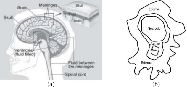 Gambar 1. Pembagian daerah utama pada : (a) Struktur otak (McLean, 2012). (b) Tumor otak (Liu et al., 2014)
