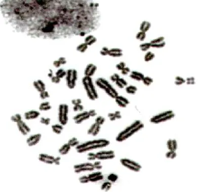 Gambar 1.2. Bentuk khromosom di bawah mikroskop 