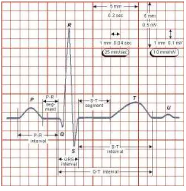 Gambar 1. Diagram blok system pengenalan sinyal ECG   