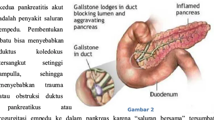 Gambar 2Gambar 2