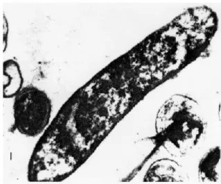 Gambar 2. Thiobacillus  (Wikipedia, 2008) 