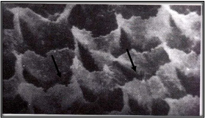 Gambar 5. Arah panah menunjukkan hasil Scanning Electron Microscopy (SEM) enamel tags yang terbentuk setelah pengetsaan pada permukaan enamel yang akan diisi oleh resin sehingga membentuk resin tags.28 