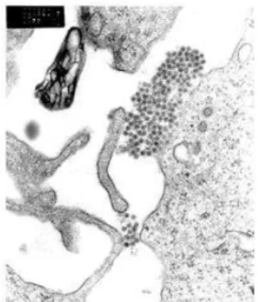 Gambar 1.1 Virus Dengue dengan TEM micrograph Klasifikasi Virus