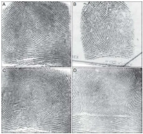 Gambar 2.1 Pola pada ridge. (A) Arch, (B) Left slant loop,  (C) Right slant  loop, (D) Whorl