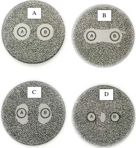 Gambar 2.4 Gambaran efek kombinasi agen antimikroba secara DDT Keterangan:  A= Kombinasi bersifat aditif B= Kombinasi bersifat sinergis C= Kombinasi bersifat antagonis D= Kombinasi bersifat sinergis (Sumber: Schwalbe, et al., 2007)