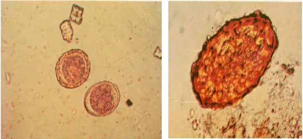 Gambar 2: telur cacing A. lumbricoides