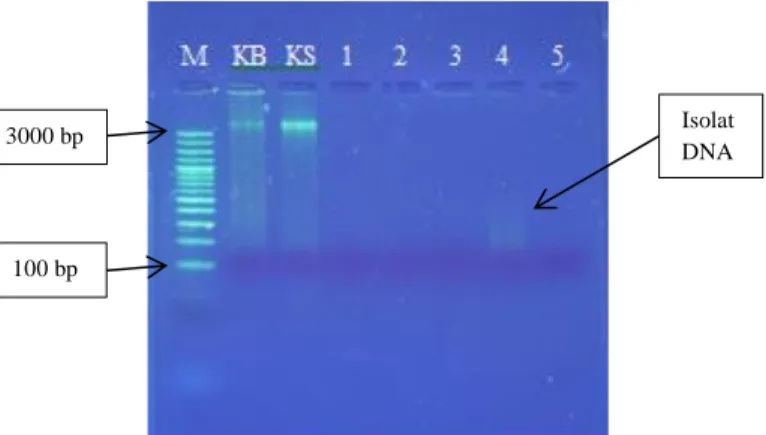 Gambar 4. Hasil Elektroforesis Isolat DNA Sampel dengan Perlakuan  Keterangan : 