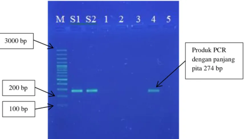 Gambar 8. Hasil Analisis Kualitatif Produk PCR dengan Primer Reverse Sapi  Keterangan : 