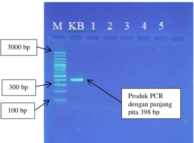 Gambar 9. Hasil Analisis Kualitatif Produk PCR dengan Primer Reverse Babi  Keterangan : 
