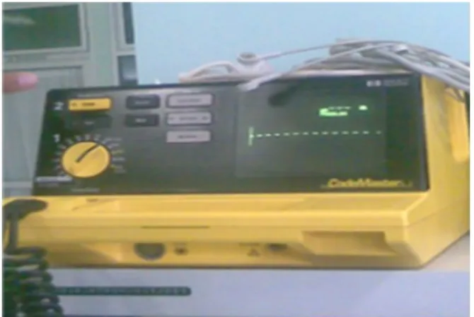 Gambar deflibrator