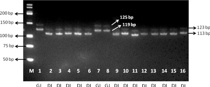 Gambar 1. Visualisasi hasil amplifikasi mikrosatelit lokus ILSTS017 pada mesin  PCR (M) Marker; 1-11 Sapi Bali Bertanduk; 12-16 Sapi Polled