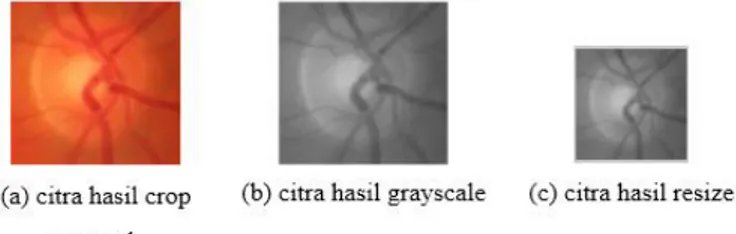 Gambar 6. Crop manual citra retina untuk mendapatkan daerah optik disk 