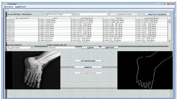 Gambar 2.3. Tampilan dari Database Citra X-ray 