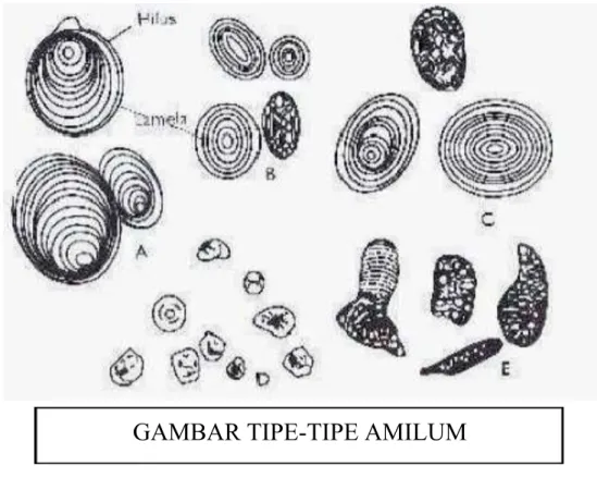 GAMBAR TIPE-TIPE AMILUM