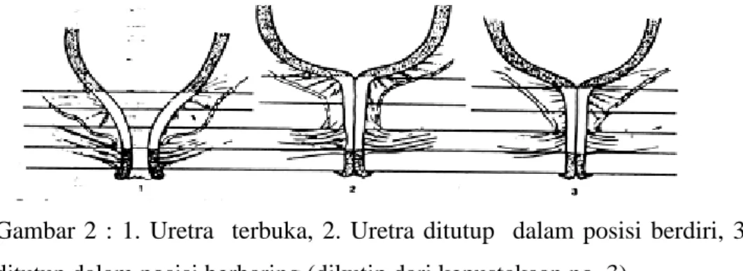 Gambar  2  :  1.  Uretra    terbuka,  2.  Uretra  ditutup    dalam  posisi  berdiri,  3