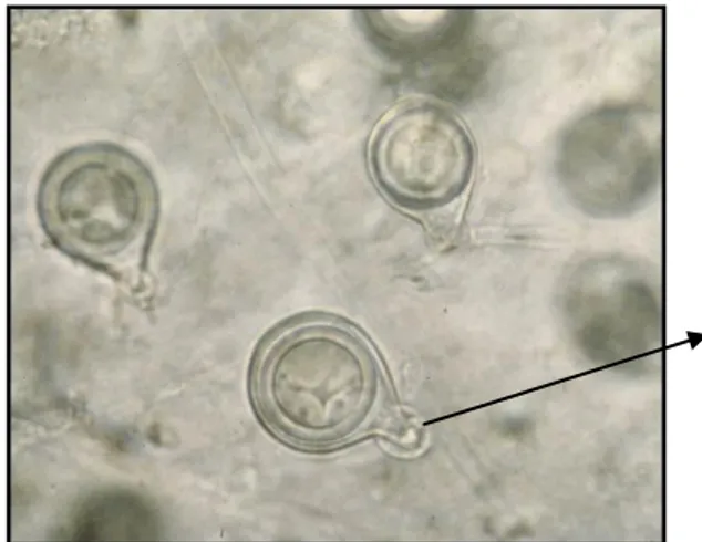 Gambar 2.  Spora jamur Phytophthora palmivora dengan tonjolan papila disalah         satu ujungnya (Sumber: Anonim, 2008) 