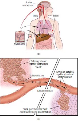 Gambar 1. Skema Proses Metastasis. (a) Pembentukan sel tumor  metastasi pada asal tumor primer (b) Sel tumor metastase lepas dari  tumor primer kemudian masuk ke pembuluh darah