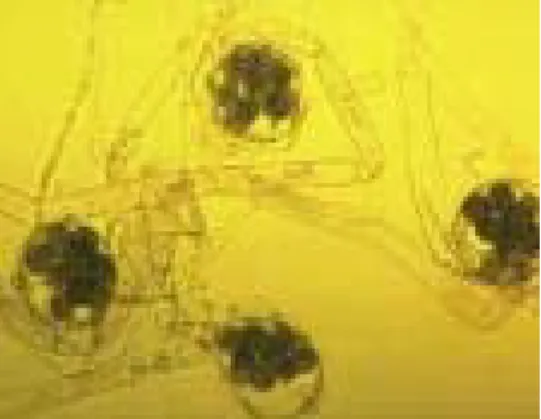 Gambar 8.14. Achlya sp 