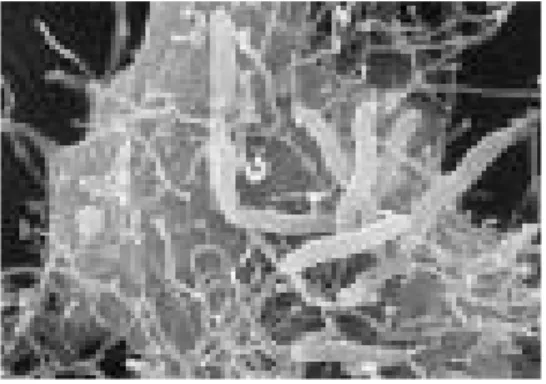 Gambar 8.16. Aeromonas sp