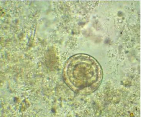 Gambar telur Hymenolepis diminuta