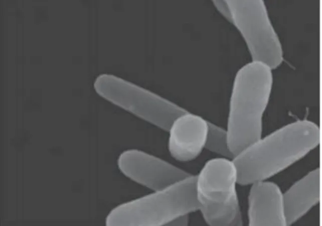 Gambar 2.6 Pseudomonas aeruginosa (Soedarto, 2016)  Klasifikasi bakteri Pseudomonas aeruginosa (Soedarto, 2015)   Kingdom  : Bacteria  