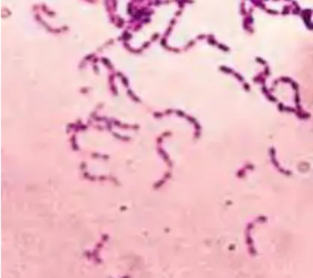 Gambar 2.9. Streptococcus Mutans (Nishimura et al., 2012). 