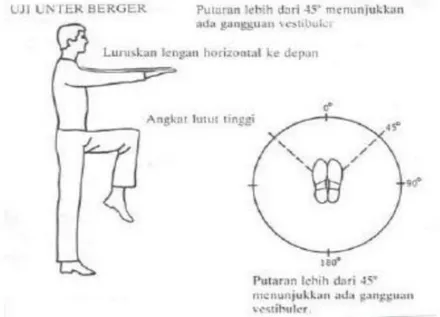 Gambar 4. Uji Unterberger  5 4.  Past-pointing test (Uji Tunjuk Barany) 