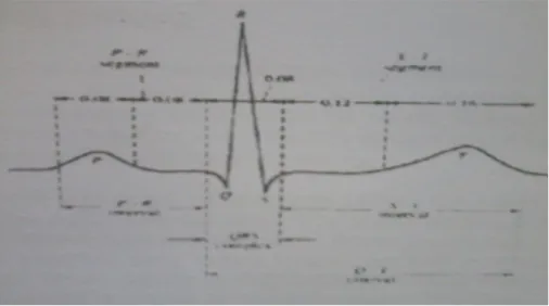 Gambar 2.3 Sinyal jantung normal 