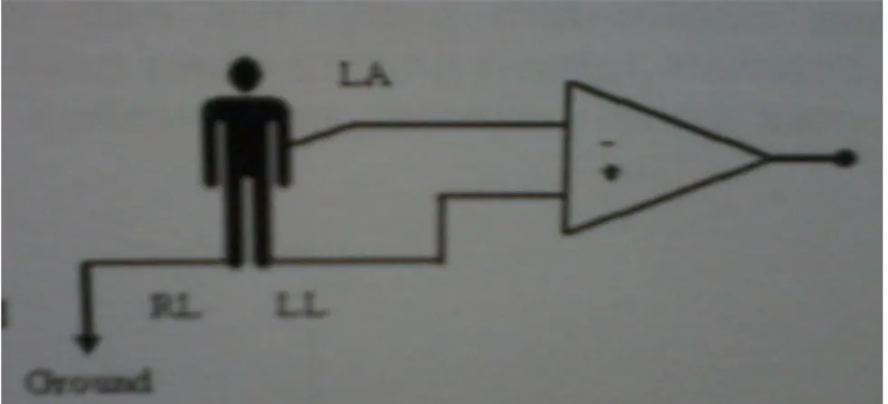 Gambar 2.7 Lead III 