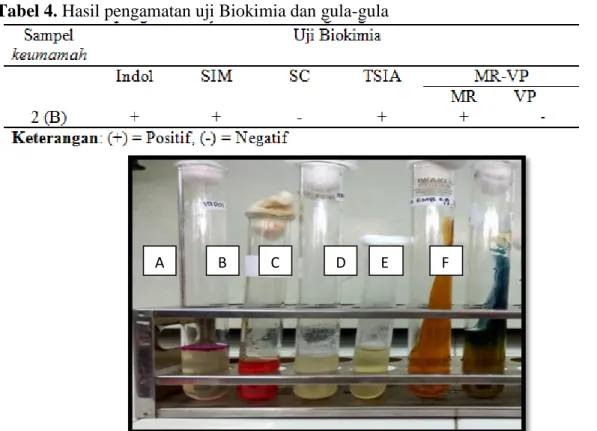 Gambar 5. Hasil identifikasi  E. coli pada uji IMVIC (A) Uji Indol, (B) Uji MR, (C) Uji VP,  (D) Uji SIM, (E) Uji TSIA, (F) Uji Simmons citrate 