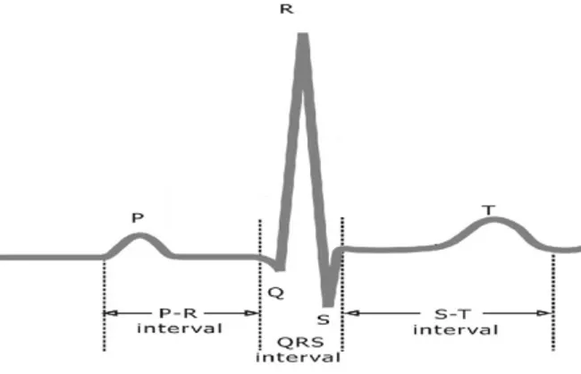 Gambar 1. Bentuk Gelombang Listrik Jantung  Makna bentuk gelombang pada EKG adalah sebagai berikut