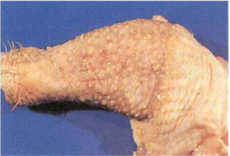 Gambar 3. Tumor pada kulit kaki ayam (Anonimus, 2007)  