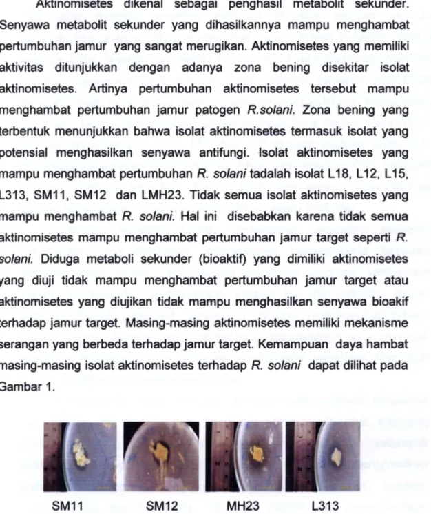 Gambar 1 Aktivitas Isolat Aktinomisetes dengan jamur R.solani dalam  medium  C G A 
