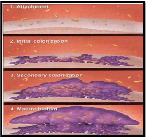 Gambar 1. Gambaran tahap pembentukan plak biofilm. 1. Pelekatan Bakteri  2. Kolonisasi awal 3