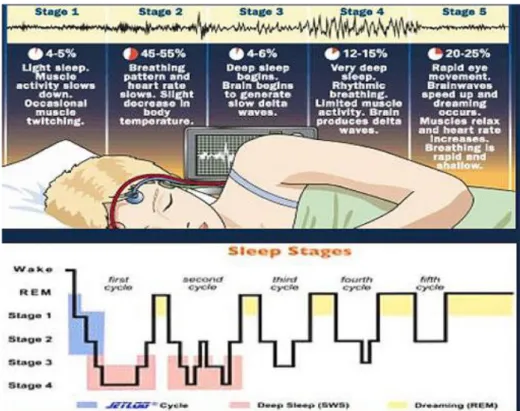 Gambar 2. Fase Tidur Dikutip dari Sleepdex 41 2.2.4  Gangguan Tidur 