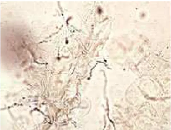 Gambar 7. Microsporum canis dilihat dengan menggunakan KOH 14
