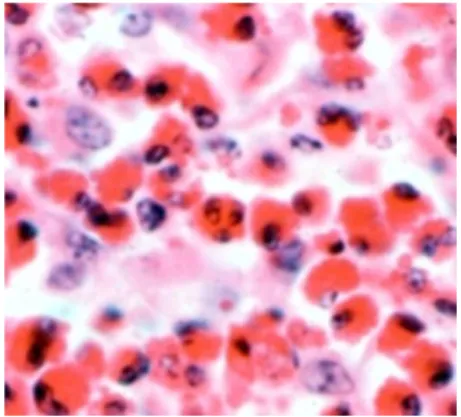 Gambar 5 Heterofil pada darah  [Sumber: Anomim 1996]. 