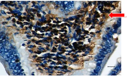 Gambar  1          Mukosa  usus  halus  dengan  pewarnaan  imunohistokimia  menggunakan  antibodi  monoklonal  NFκB  pada  kelompok  yang  mendapat  bawang  putih  20mg/kgBB