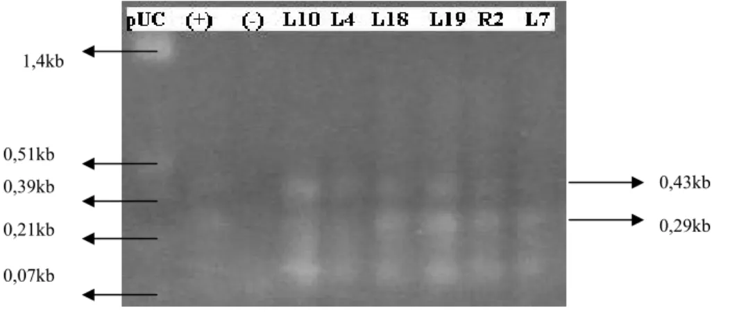 Gambar IV.1 Elektroforesis Gel Agarosa Hasil PCR Multiplek. Gen katG315  enam isolat MDR-TB (L10, L4, L18,L19,R2,L7), kontrol (+): isolat  galur normal H37Rv, kontrol (-): air