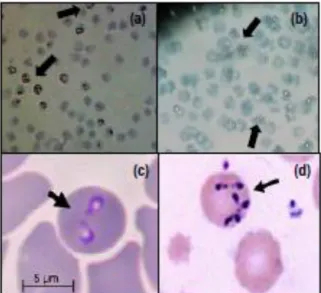 Gambar  2.  Merozoit  Babesia  sp.  pada  eritosit  hasil  penelitian  yang  di  warnai  dengan  giemsa  10%  (a,b);  hasil  penelitian  Hunfeld  dkk.,  (2008)  (c,d)
