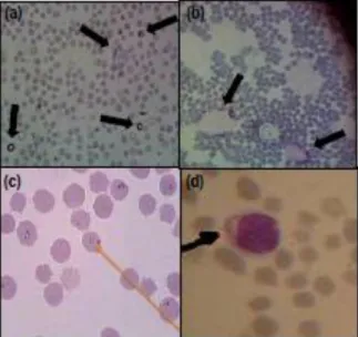 Gambar 4. Gambaran darah sapi yang menderita  Trypanosomiasis (a,b) (Taylor, 2007). Gambaran  darah  sapi  hasil  penelitian  yang  tidak  menderita  Trypanosomiasis  (c)