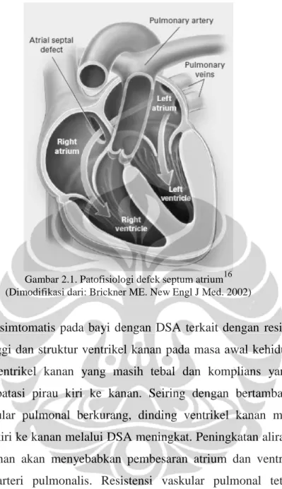 Gambar 2.1. Patofisiologi defek septum atrium 16 (Dimodifikasi dari: Brickner ME. New Engl J Med