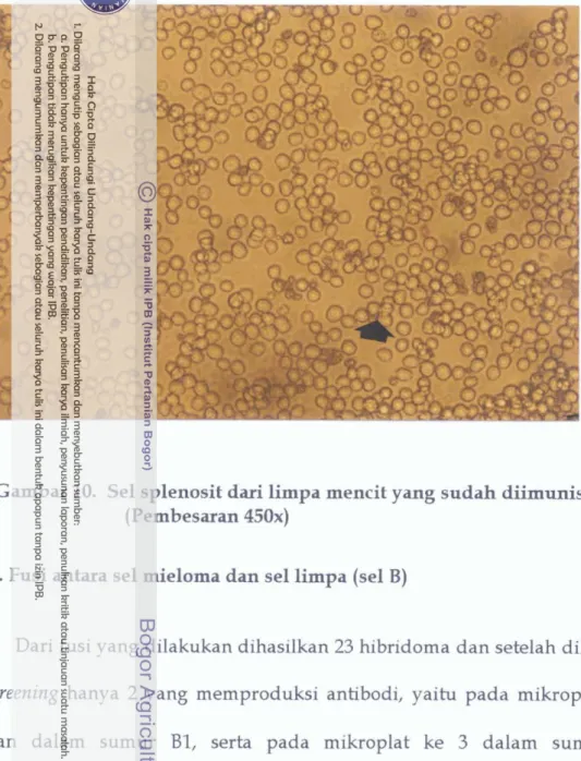 Gambar  10.  Sel splenosit dari limpa mencit yang sudah diimunisasi  (Pembesaran  450x) 